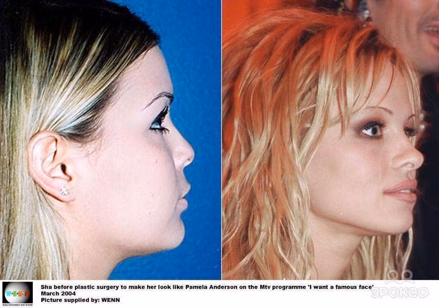 Khi fan cuong phau thuat tham my de giong sao-Hinh-13