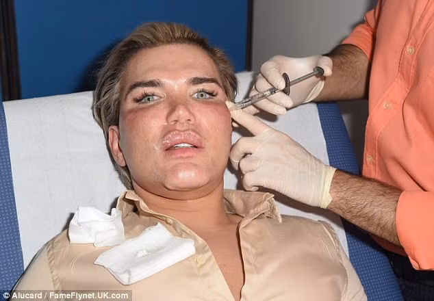 Can canh 3 tieng tiem botox cua bup be song Ken Doll-Hinh-3