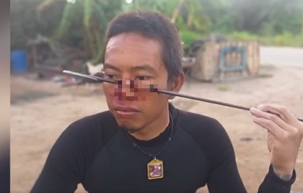 Cần thủ "hậu đậu" tự bắn ngọn giáo dài 1,2m xuyên qua mặt Can thu