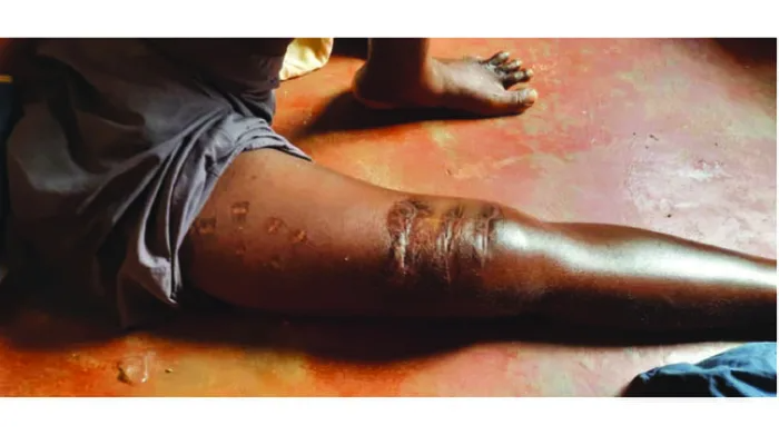 Bi 3 con ca sau tan cong, nguoi dan ong song sot than ky-Hinh-2