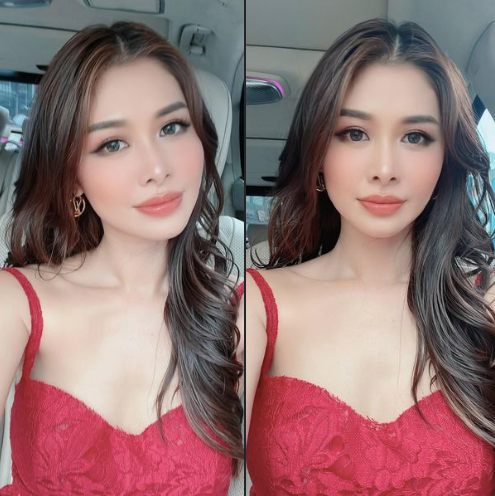 Nghi van phau thuat tham my, ba xa Dang Khoi phan ung the nao?-Hinh-2