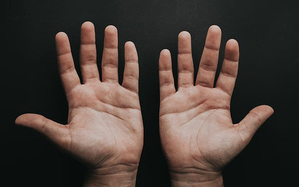 Nếu các đường vân tay giữa lòng bàn tay xen kẽ nhau và tạo thành một hình vuông lớn hay hình tam giác thì được gọi là kho bạc và đại diện cho sự giàu có, thịnh vượng.