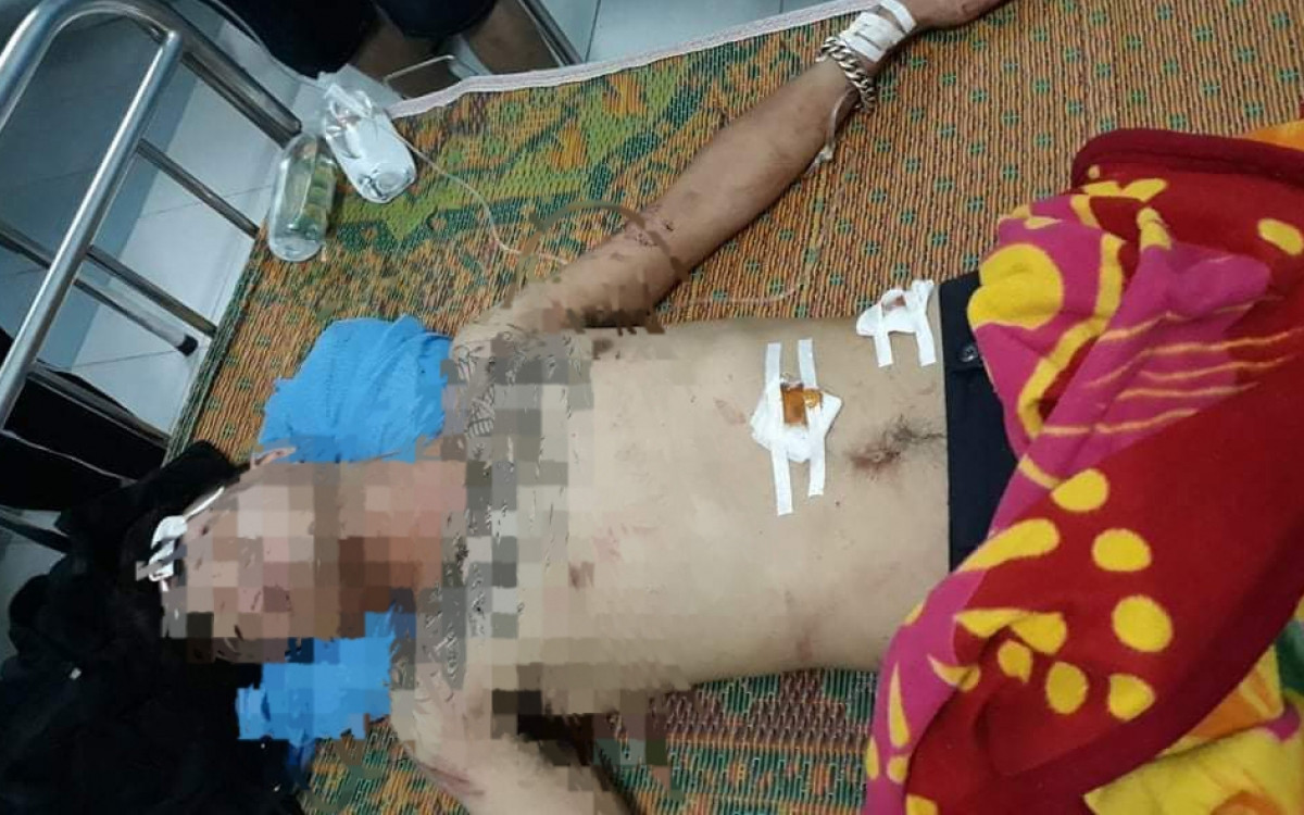  6. Tạm giữ đối tượng dùng súng giải quyết mâu thuẫn: Ngày 30/9, Công an huyện Ba Bể, tỉnh Bắc Kạn vừa tạm giữ một đối tượng để điều tra hành vi sử dụng súng trái phép. Trước đó, tại quán Karaoke ở huyện Ba Bể, Vũ Ngọc Dương (SN 1994) đã dùng súng bắn vào Lý Văn Sự SN 1995 (đều trú tại huyện Ba Bể) vì mâu thuẫn khi hát trong quán Karaoke.