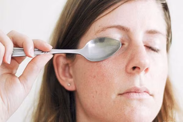  Thìa lạnh. Đặt vài thìa vào tủ lạnh khoảng 5 -10 phút, sau đó đặt mặt ngửa của thìa vào phần bọng mắt cho đến khi thìa ấm. Cách này sẽ làm giãn các mạch máu và mệt mỏi của mắt. 