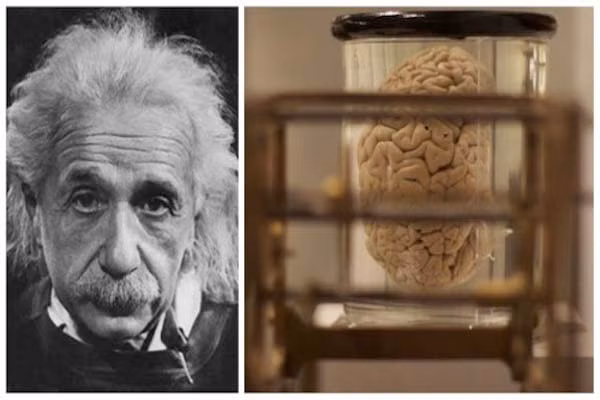 6. Não bộ của nhà khoa học vĩ đại nhất thế giới Albert Einstein giống như não của một đứa trẻ. Điều này có vẻ ngược đời với một nhà bác học có trí tuệ siêu phàm. Tuy nhiên, sau khi qua đời, ông trao lại bộ não của mình cho khoa học y tế.