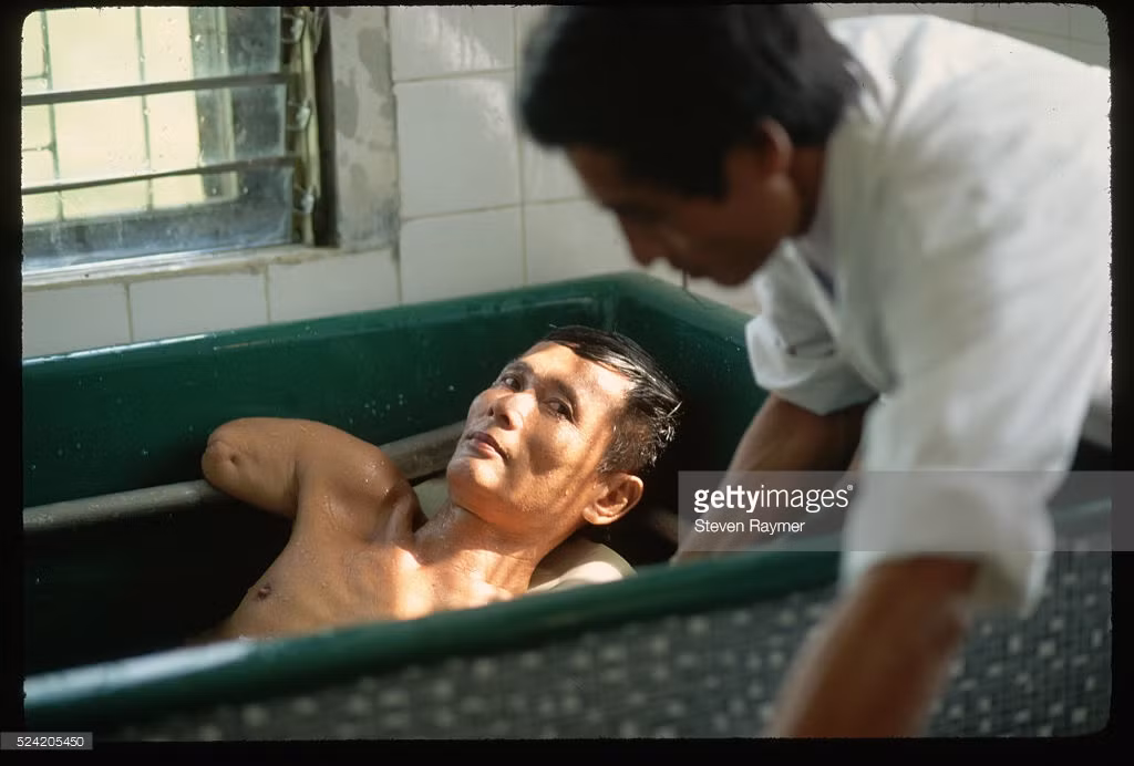 Một cựu chiến binh cụt tay được điều dưỡng chăm sóc tại một trung tâm thương binh ở ngoại thành Hà Nội, 3/8/1993.