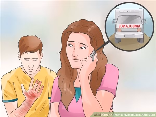 Tuy nhiên, trong trường hợp nạn nhân có dấu hiệu sốc, như ngất, da xanh tái hoặc thở nông. Vết bỏng hóa chất thâm qua lớp da ngoài cùng, và gây bỏng độ 2 trên diện tích có đường kính trên 5 - 8cm. Bỏng hóa chất xảy ra ở mắt, bàn tay, bàn chân, mặt, bẹn hoặc mông hoặc ở khớp lớn thì phải gọi ngay cấp cứu hoặc đưa người bị nạn tới bệnh viện gần nhất...