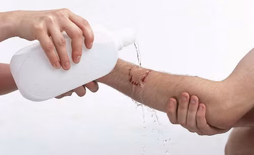 Rửa sạch vùng da bị dính axit dưới vòi nước chảy trong vòng 15 phút trở lên, làm sao để nước dội axit ra khỏi phần da bị bỏng và không chảy hay dính vào các vùng da khác. Nước không nên lạnh quá, vừa đủ mát để làm dịu dùng da bị bỏng.