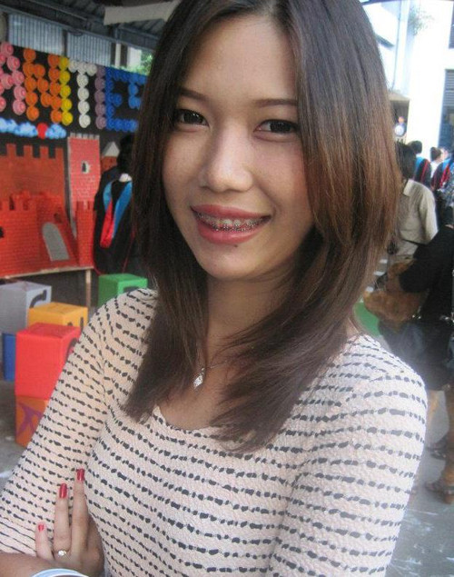 Cô vợ trẻ quên đi nỗi đau bị chồng chê, nhổ 2 chiếc răng hàm, đeo niềng răng hơn 4 năm trời để chỉnh lại hàm răng nhấp nhô của mình. Câu phẫu thuật thẩm mỹ chỉnh sửa gần như toàn bộ khuôn mặt, từ mắt, mũi, môi và chăm sóc để da hết sần sùi.