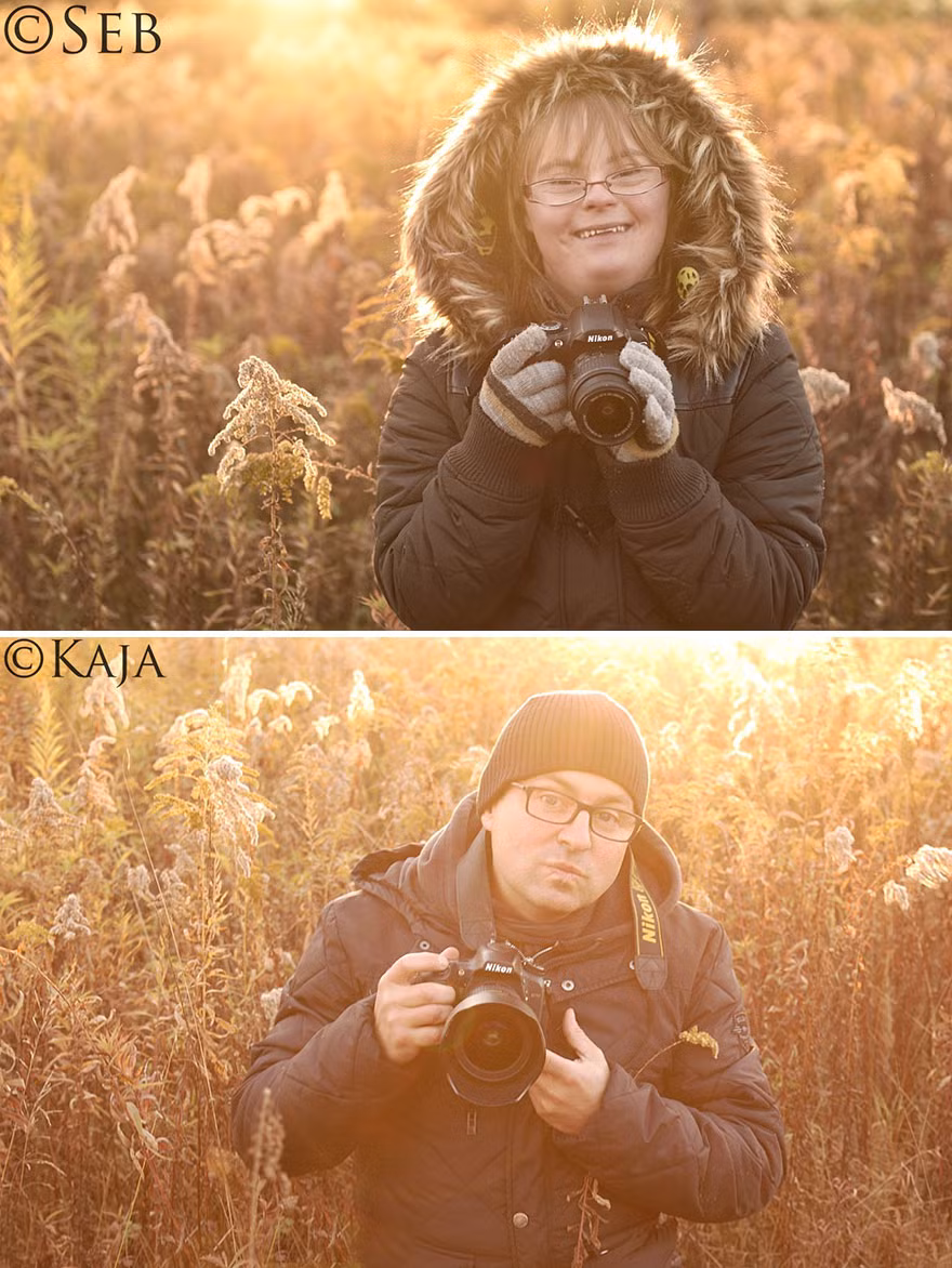 Cam dong co gai mac benh down dam me chup anh