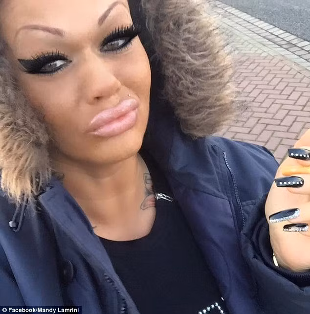 Bức ảnh của cô là mục tiêu của nhóm troll trực tuyến, họ chế ảnh, cắt ghép khuôn mặt và đôi lông mày của cô biến dạng, cùng vô số các lời bình luận ác ý.