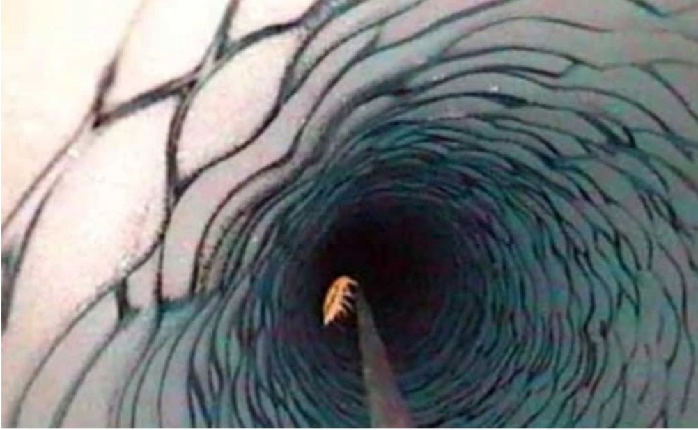 Bi an ‘ho ma quy’ bi 'giam cam' 25 trieu nam duoi lop bang