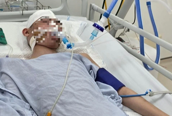  Nam sinh lớp 8 ở Hà Nội bị đánh chấn thương sọ não: Ngày 25/3, Công an quận Long Biên (Hà Nội) cho biết, đơn vị đang điều tra vụ nam sinh bị đánh chấn thương sọ não. Theo phản ánh của chị L., chiều 17/3, con trai chị là cháu N.H.Đ. (14 tuổi, nam sinh lớp 8 trường THCS Việt Hưng) chơi bóng rổ tại sân đình Lệ Mật thì xảy ra mâu thuẫn với cháu K. (12 tuổi). K. đã gọi anh trai (16 tuổi) và bố ra rồi K. và anh trai K. đánh Đ. khiến cháu bị chấn thương sọ não nặng. 