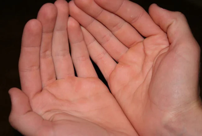  Lòng bàn tay tụ Thủy: Khi bạn thấy lòng bàn tay của mình tụ thủy, tức là lòng bàn tay có thể đựng nước thì đó là dấu hiệu cực kỳ may mắn. Bàn tay của con người có thể làm nên tất cả, tự dựng nên cơ đồ riêng của mình.