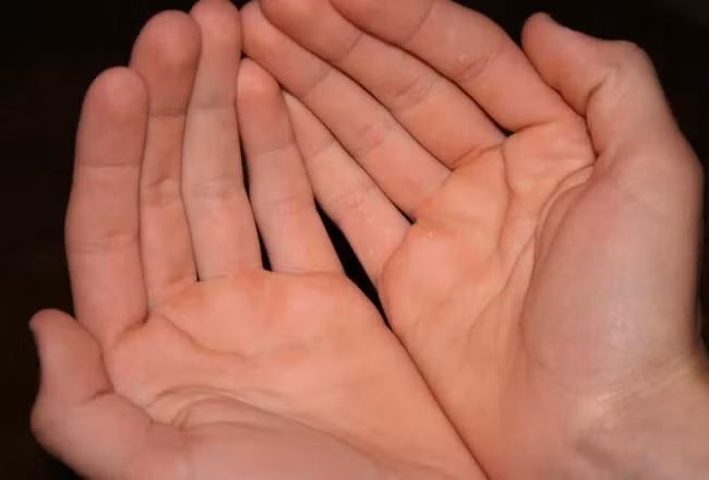  Lòng bàn tay tụ Thủy: Khi bạn thấy lòng bàn tay của mình tụ thủy, tức là lòng bàn tay có thể đựng nước thì đó là dấu hiệu cực kỳ may mắn. Bàn tay của con người có thể làm nên tất cả, tự dựng nên cơ đồ riêng của mình.