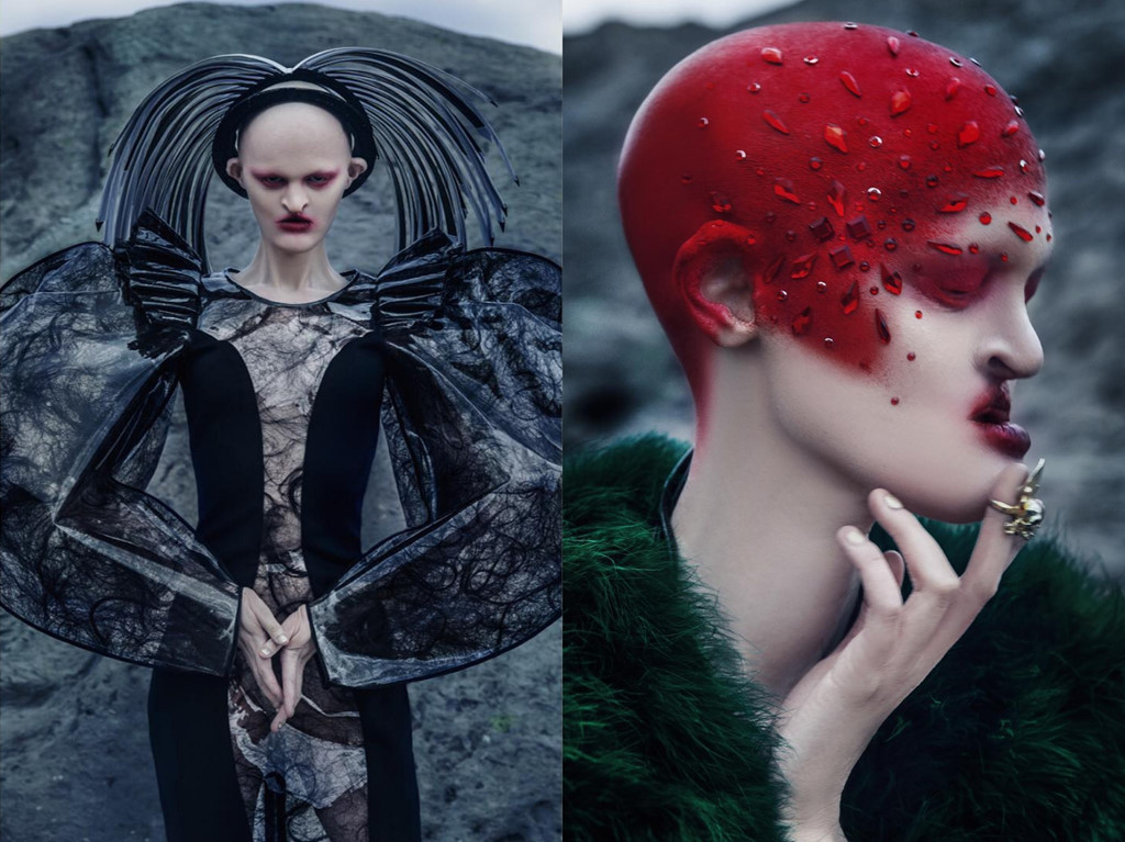 Melanie Gaydos là trường hợp đặc biệt nhất trong làng mốt khi bị chứng rối loạn gen di truyền ectodermal dysplasia, dẫn đến rụng tóc và răng, móng, sụn và xương không phát triển bình thường. Ngoại hình xấu lạ khiến chân dài 29 tuổi không tránh khỏi sự dè bỉu, miệt thị từ những người xung quanh. Song, chính niềm đam mê người mẫu đã thôi thúc cô đi tìm câu trả lời cho khả năng của bản thân mình.