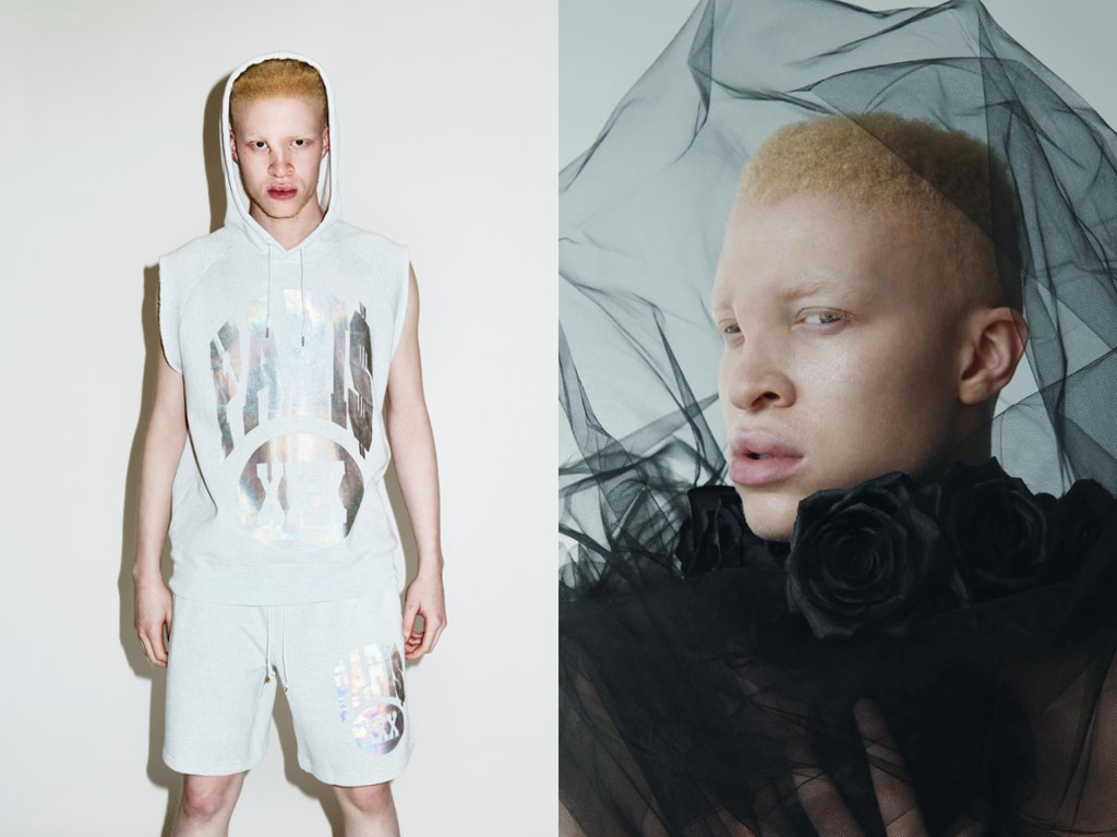 Tạm gác đam mê vũ công để theo đuổi hào quang sàn catwalk, Shaun Ross nhanh chóng gây chú ý khi là nam người mẫu đầu tiên bị bệnh bạch tạng. Con đường sự nghiệp của Ross không hề dễ dàng, anh thường xuyên bị bắt nạt vì ngoại hình khác biệt. Nhưng điều đó không khiến Ross buồn, anh biến nó thành động lực để cố gắng. Kết quả là người ta thấy anh xuất hiện trên loạt ấn phẩm của GQ, Vogue, i-D Magazine, Paper Magazine và Another Man. Chưa hết, Ross còn được hai nhà mốt lừng danh Alexander McQueen và Givenchy mời diễn show thời trang.