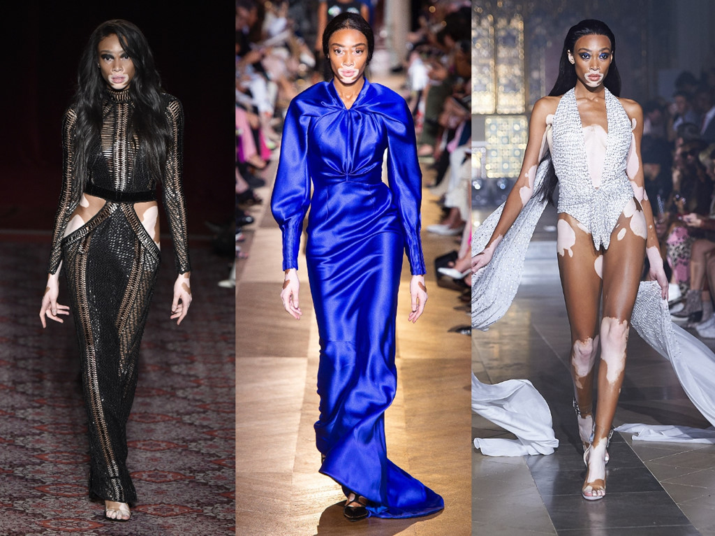 Sau chương trình, Harlow được nhắc đến với vẻ đẹp truyền cảm hứng, phá bỏ mọi tiêu chuẩn. Điểm đặc biệt trên cơ thể đã giúp cô được nhiều nhãn hàng săn đón, trở thành gương mặt xuất hiện đều đặn tại các tuần lễ thời trang danh giá nhất thế giới. Mới đây, người mẫu cao 1,75 m chính thức gia nhập hàng ngũ chân dài của Victoria's Secret và cô sẽ được diễn show thường niên vào cuối năm nay. "Loài người có da đen và da trắng, còn tôi có cả hai", Harlow nhấn mạnh.