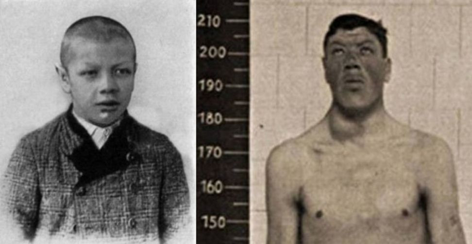 Đến năm 21 tuổi, ông Rainer phát triển chiều cao đáng kinh ngạc khi cao tới 216 cm. Trước sự phát triển chiều cao đột ngột, các bác sĩ đã tiến hành kiểm tra sức khỏe cho ông. Theo đó, họ phát hiện ông mắc phải căn bệnh có tên là to đầu chi (acromegaly).