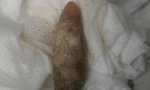 San ho hinh tay nguoi chet gay nham lan cho canh sat