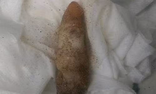 San ho hinh tay nguoi chet gay nham lan cho canh sat