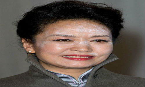 Những bức ảnh ghi lại cho thấy, khuôn mặt của bà Bành lộ rõ lớp bột màu trắng trên trán và mũi. Nguyên nhân là do phấn phủ silica phản chủ khi bị ánh đèn flash của máy ảnh chiếu vào.