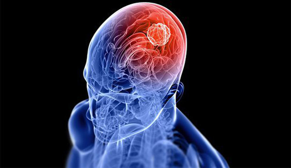 Thật không may, thuốc nhuộm màu vàng cho trang phục có thể chứa PCB11 bị cấm từ lâu. Đây là một dạng polychlorinated biphenyl có thể gây kích ứng da, mụn trứng cá nặng, ung thư gan, ung thư túi mật, ung thư đường mật, ung thư đường tiêu hóa và ung thư não. (Ảnh minh họa)