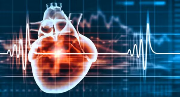 Nguyên nhân gây nhồi máu não được chia thành 2 loại. Một là, lối sống không lành mạnh như hút thuốc, uống rượu, ăn nhiều muối, ít vận động, béo phì, dễ kích động... Hai là, cơ thể mắc các bệnh như huyết áp cao, tiểu đường, tim mạch vành, gan nhiễm mỡ, rối loạn nhịp tim...