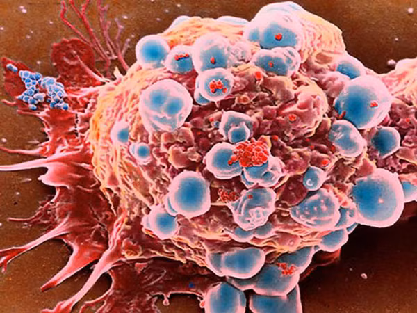 Nghiên cứu ở quy mô lớn, chuyên gia nhận thấy sự xáo trộn đồng hồ sinh học sẽ làm tăng nguy cơ mắc ung thư.