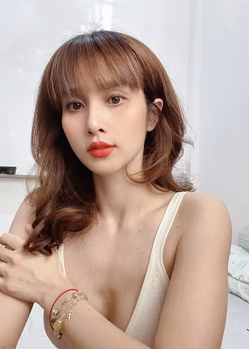 Gương mặt của nữ diễn viên chuẩn Vline sau 5 năm can thiệp dao kéo.