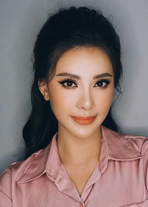 Gương mặt của Kim Duyên thon gọn hơn, sống mũi cao hơn so với trước đây.