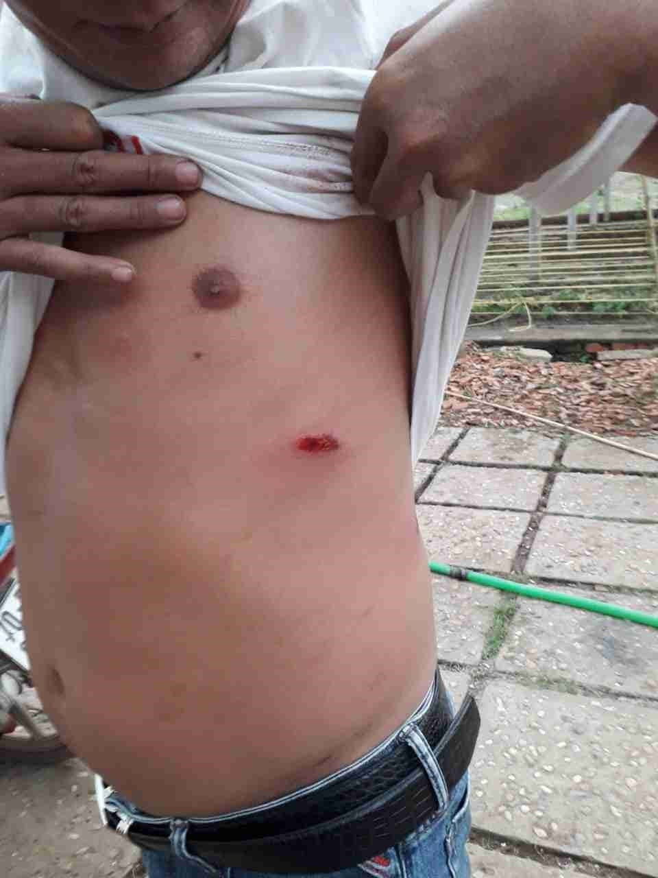 Khởi tố vụ giang hồ xăm trổ nổ súng truy sát cả gia đình ở Sài Gòn - Hình 2 Khoi to vu giang ho xam tro no sung truy sat ca gia dinh o Sai Gon-Hinh-2