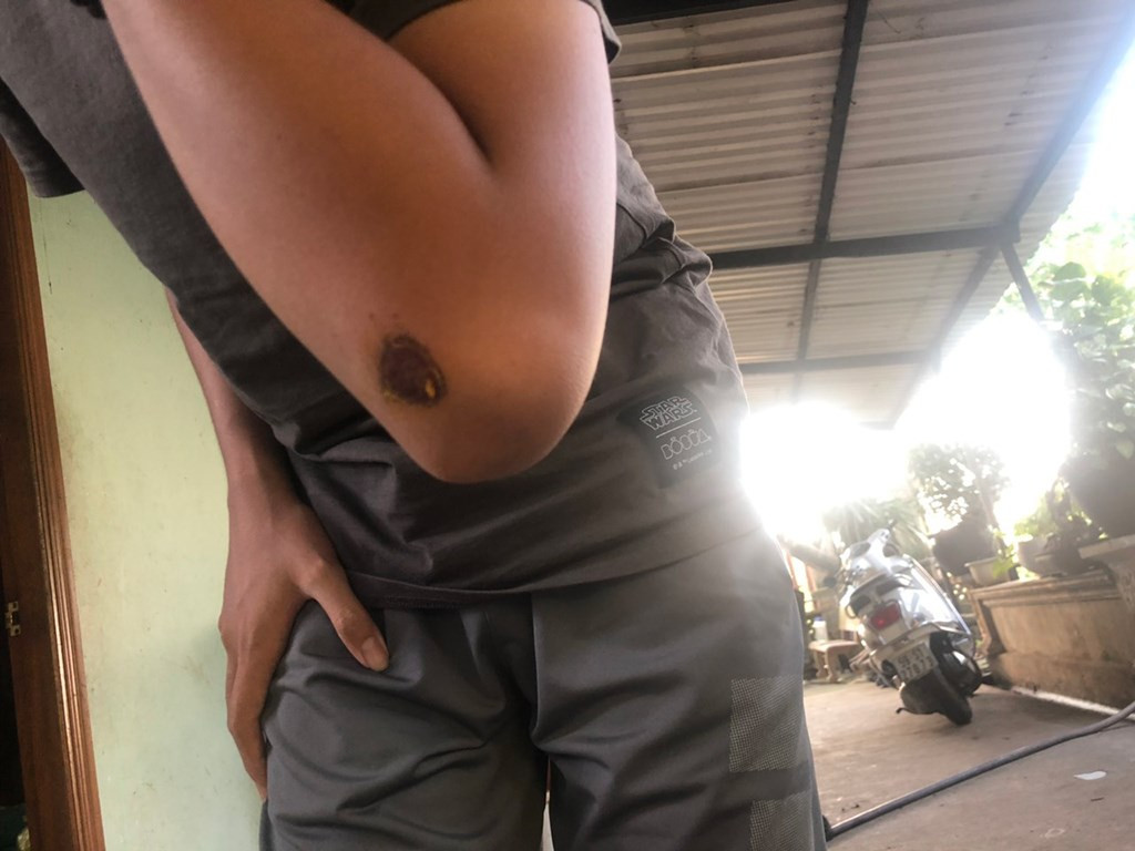 Cả gia đình đánh nhau với nhóm trộm có súng như phim giữa đêm - Hình 2 Ca gia dinh danh nhau voi nhom trom co sung nhu phim giua dem-Hinh-2