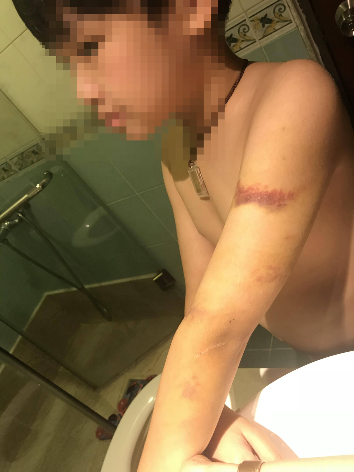 Nghi an be trai 10 tuoi bi cha va me ke bao hanh o chung cu Flemington: Thong tin bat ngo-Hinh-2