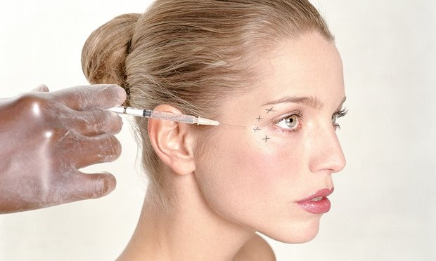 Phương pháp tiêm botox bắt đầu phát huy tác dụng xóa nếp nhăn từ ngày thứ 3 và đạt hiệu quả cao sau 1-2 tuần. Ảnh: alobacsi.