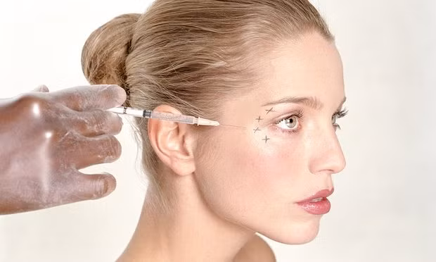 Phương pháp tiêm botox bắt đầu phát huy tác dụng xóa nếp nhăn từ ngày thứ 3 và đạt hiệu quả cao sau 1-2 tuần. Ảnh: alobacsi.