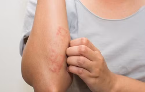 Nhiều người còn bị viêm da khi tiếp xúc với nấm mốc trong nhà. Ảnh: giaoducthoidai.