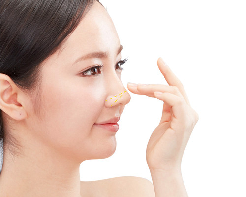 Cuối cùng, bạn nên hạn chế lượng muối tiêu thụ bởi muối làm tăng khả năng giữ nước, có thể làm nặng thêm tình trạng sưng trong quá trình phục hồi của bạn. Ảnh: viendaotaothammy.