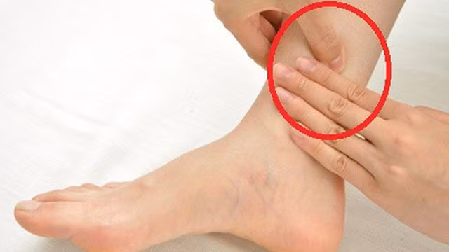 7. Bấm huyệt tam âm giao: Huyệt tam âm giao ở vùng mặt trong của cổ chân. Tính từ đỉnh xương mắt cá trong, huyệt nằm cách vị trí bằng chiều rộng của 4 ngón tay. Day ấn mạnh vào điểm này làm giảm căng thẳng và có tác dụng làm dịu chứng đau đầu.