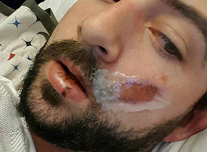 Nhung lam tuong chet nguoi ve thuoc la dien tu-Hinh-6