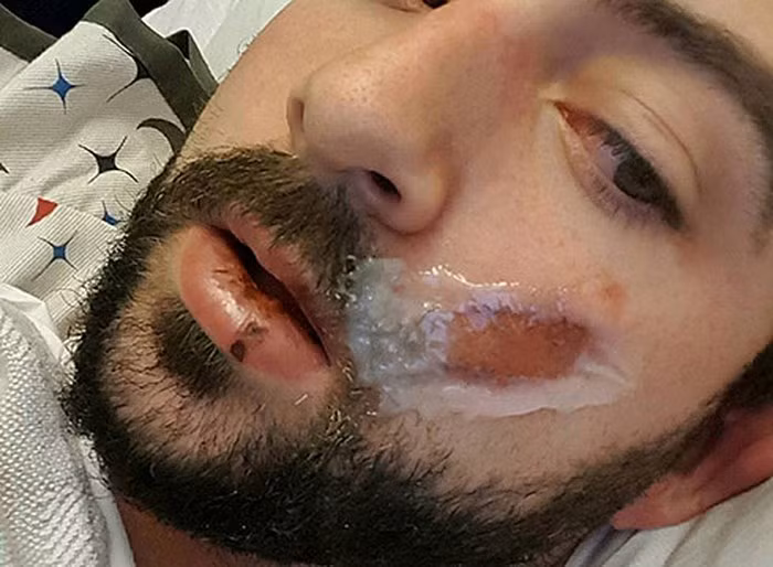 Nhung lam tuong chet nguoi ve thuoc la dien tu-Hinh-6