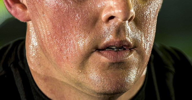 1. Ra mồ hôi ở vùng đầu Một trong những triệu chứng của việc thiếu hụt vitamin D ở người lớn là ra mồ hôi ở vùng đầu nhiều so với các bộ phận còn lại của cơ thể.