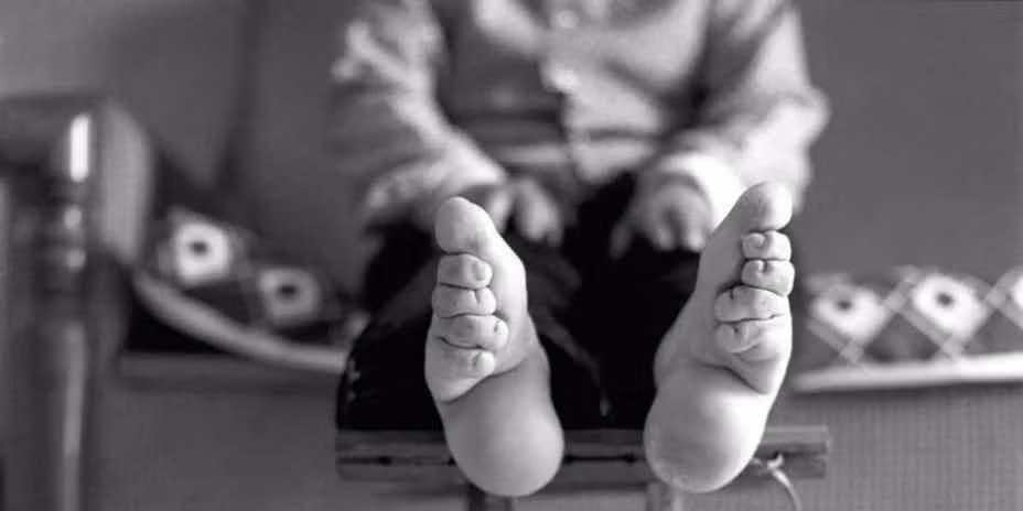 Hình ảnh đáng sợ bàn chân bị biến dạng của phụ nữ Trung Quốc sau khi thực hiện tập tục bó chân để có "gót sen ba tấc".