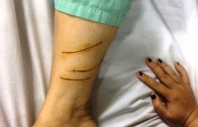 Co gai nghi cam dau nhom thanh nien truy sat thieu nu o Sai Gon-Hinh-2