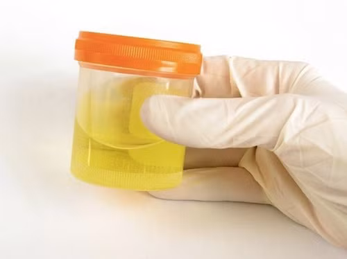 Trong Kinh Thánh và một số văn bản Ấn Độ giáo đều có nhắc đến việc uống trực tiếp nước tiểu vì quan niệm đó là dòng nước “tinh khiết”, “dòng nước của Chúa”.