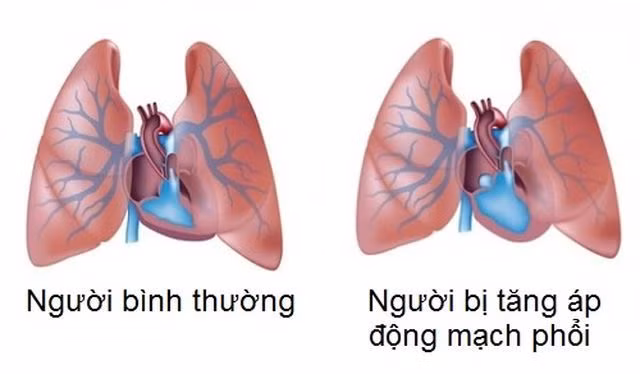 Co gai uong Viagra suot 10 nam de duy tri su song-Hinh-3