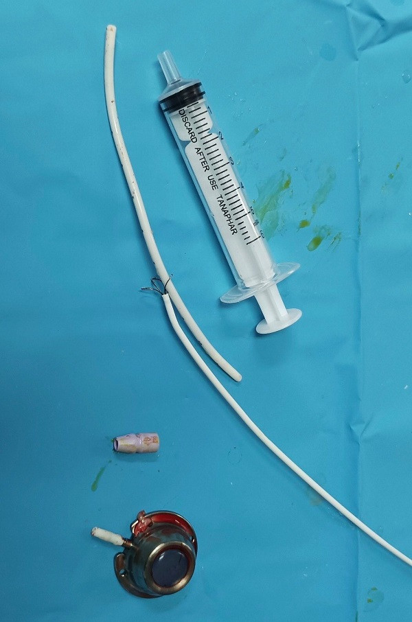 Lay manh di vat trong tim benh nhan suot 6 nam