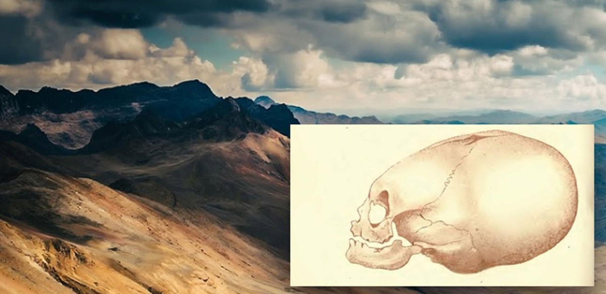 Bởi lẽ, nền văn minh Inca có tập tục kéo dài hộp sọ để thể hiện địa vị xã hội. Những người thuộc tầng lớp giàu có thường thực hiện tập tục này cho con cái từ khi còn nhỏ.