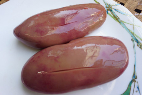 6. Thận: Thận là cơ quan bài tiết chính trong hệ tiết niệu, giúp lọc máu, loại bỏ độc tố và chất thải ra khỏi máu nên có khả năng tích tụ những chất có hại. Ảnh minh họa.