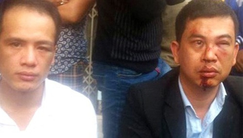 Hai luật sư Luân và Nam bị hành hung.